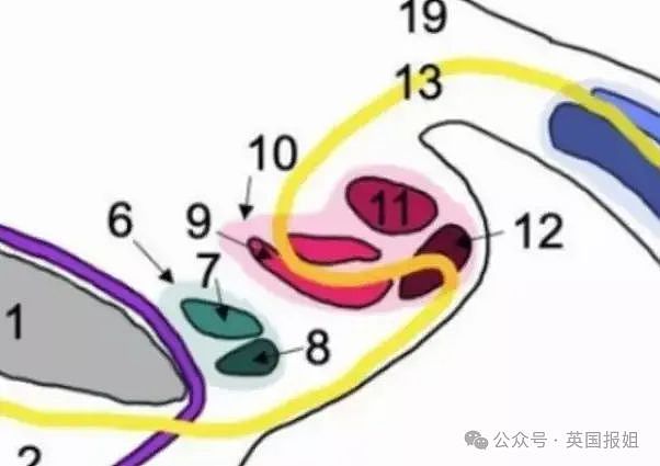 奇葩！权威报告：男子有三根丁丁？网友：画面太“美”不敢想（组图） - 18