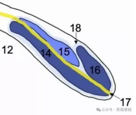 奇葩！权威报告：男子有三根丁丁？网友：画面太“美”不敢想（组图） - 19