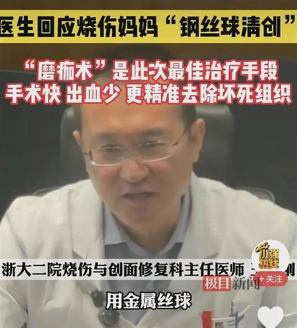 煤气爆炸也要保护孩子！让全网揪心的“烧伤妈妈”已神志清醒，医生回应用钢丝球清创（组图） - 9