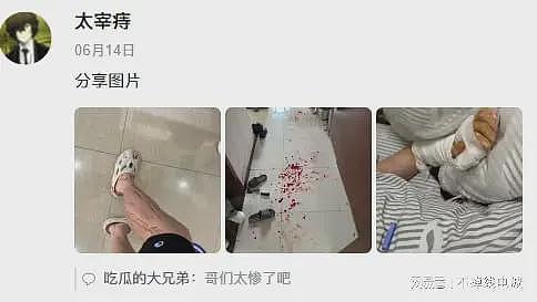 网传女子砍断男友肌腱神经被刑拘，女方家属跪求谅解未果，威胁告男方强奸（组图） - 1