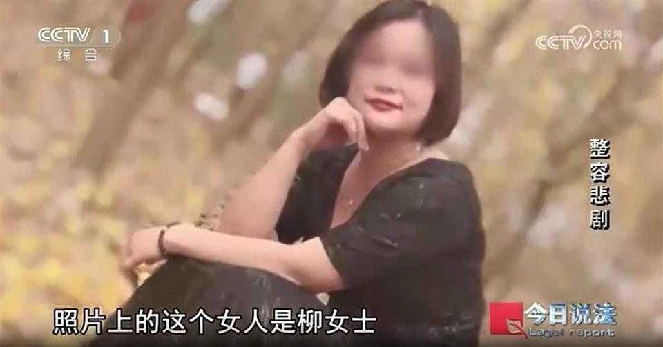 中国女子2天做6项整容手术身亡，获赔150万（图） - 1