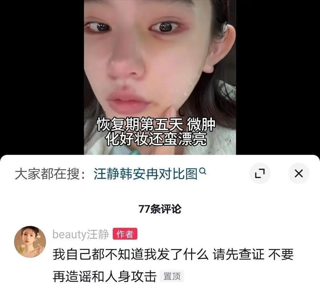 女网红举报韩安冉整容黑历史，反被曝光偷税上千万？二人撕X细节牵扯太多大瓜...（组图） - 5