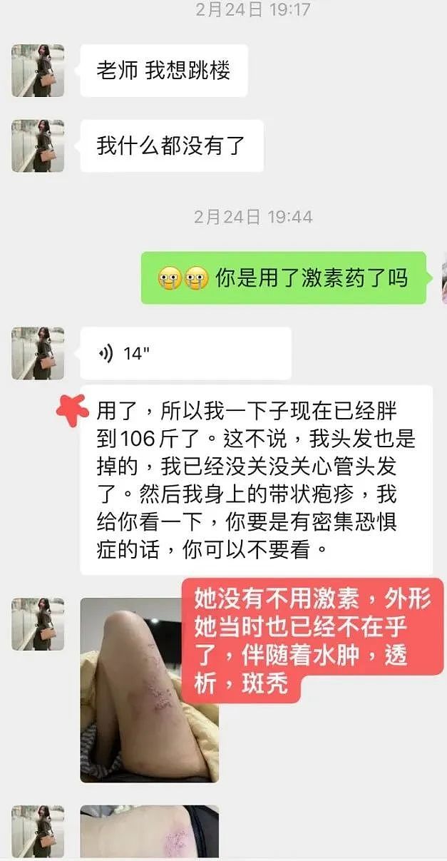 沙白死后遭网暴自私不孝，老师曝聊天记录力挺，晒腿上伤痕太揪心（组图） - 13