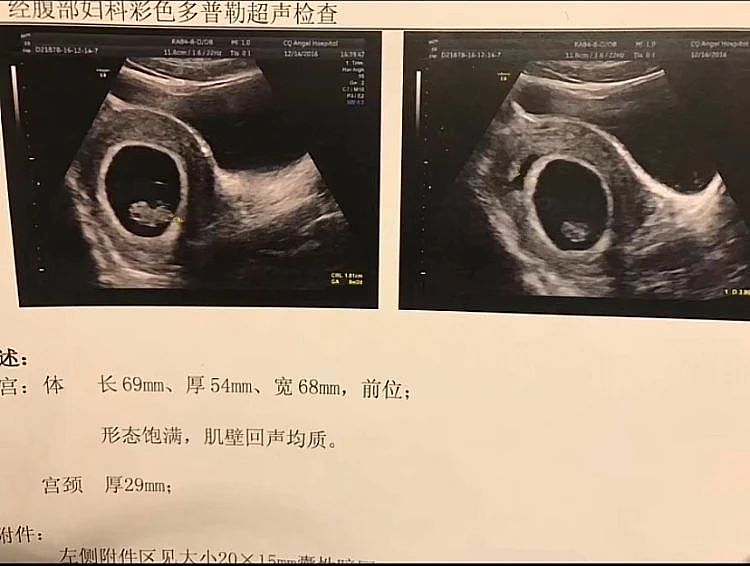 40岁，高级建筑工程师，已转行“性感博主”（组图） - 5