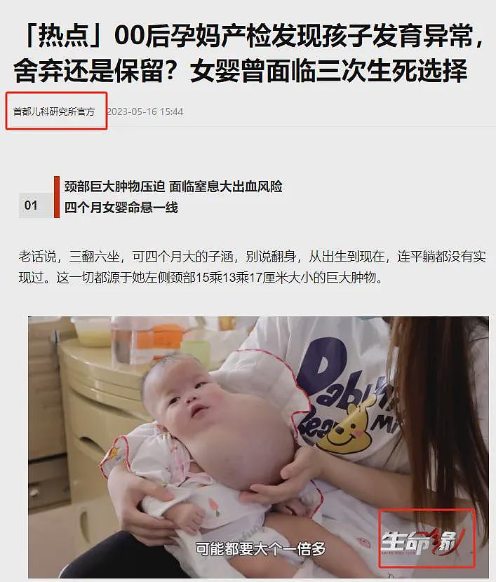 00后孕妈怀上肿瘤女婴，医生建议打掉，善良的婆婆坚持要她生下来（组图） - 17