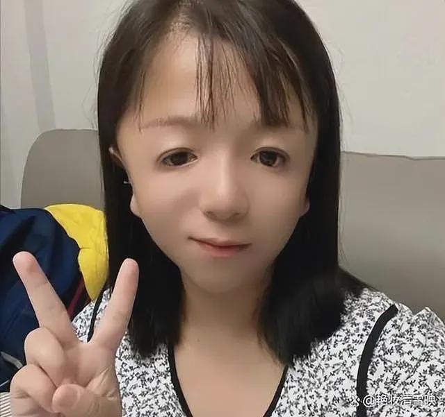 “鸟脸”妈妈不听劝阻生二胎，现如今6岁儿子外貌遗传，听力受损（组图） - 5