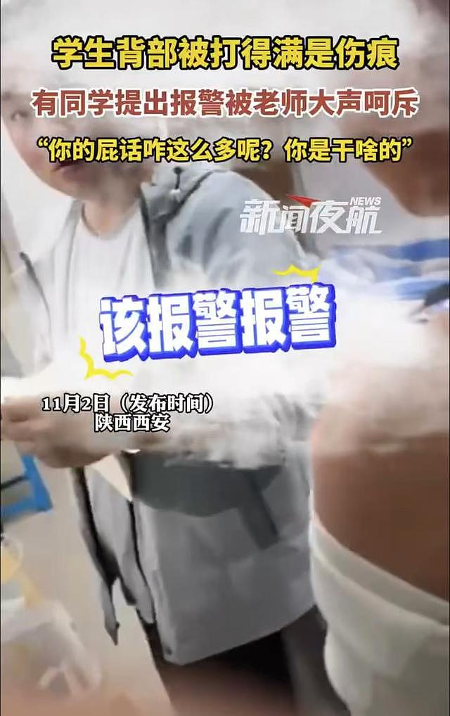 “屁话怎么那么多？”陕西一技校学生被打得伤痕累累，同学提出报警，被老师大声训斥（视频/组图） - 3