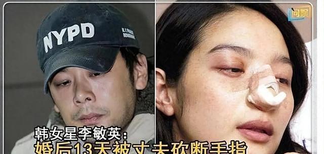 “最惨女星”的闪婚经历堪比恐怖片：新婚13天被丈夫砍断手指（组图） - 1