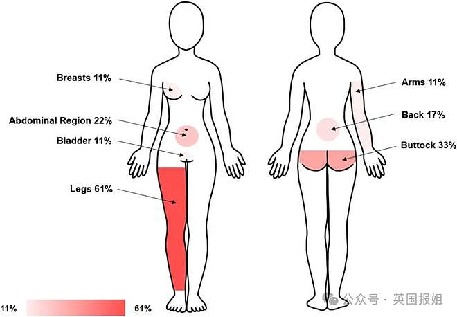 女子隐私部位得怪病，24小时持续兴奋？她崩溃：皮肤下像有虫子在烧（组图） - 4