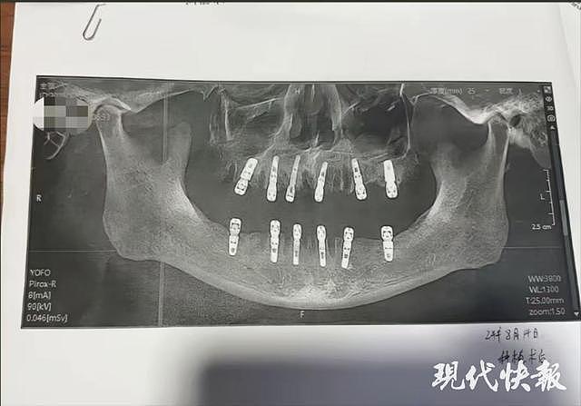 男子被诊断感染HPV治疗10天花光积蓄！换院查一切正常（组图） - 5