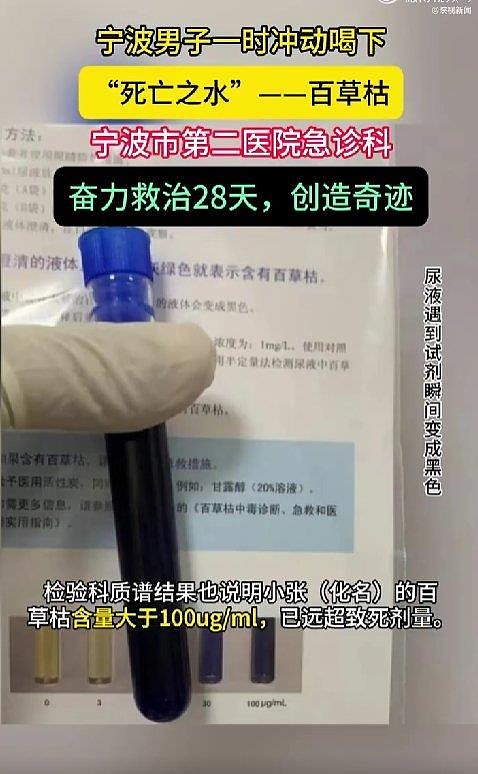 没人能生还？宁波男子喝下“百草枯”抢救28天出现奇迹（组图） - 2