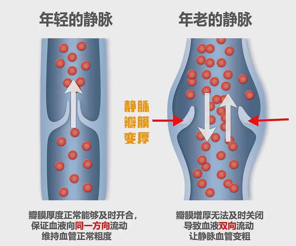 两次断崖式衰老​共同特征：血管老化（组图） - 9