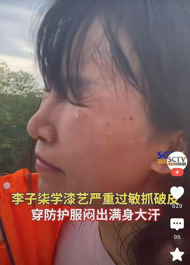 李子柒生漆过敏画面曝光！全身红肿多次进医院，老师曝出更多感人细节（组图） - 8