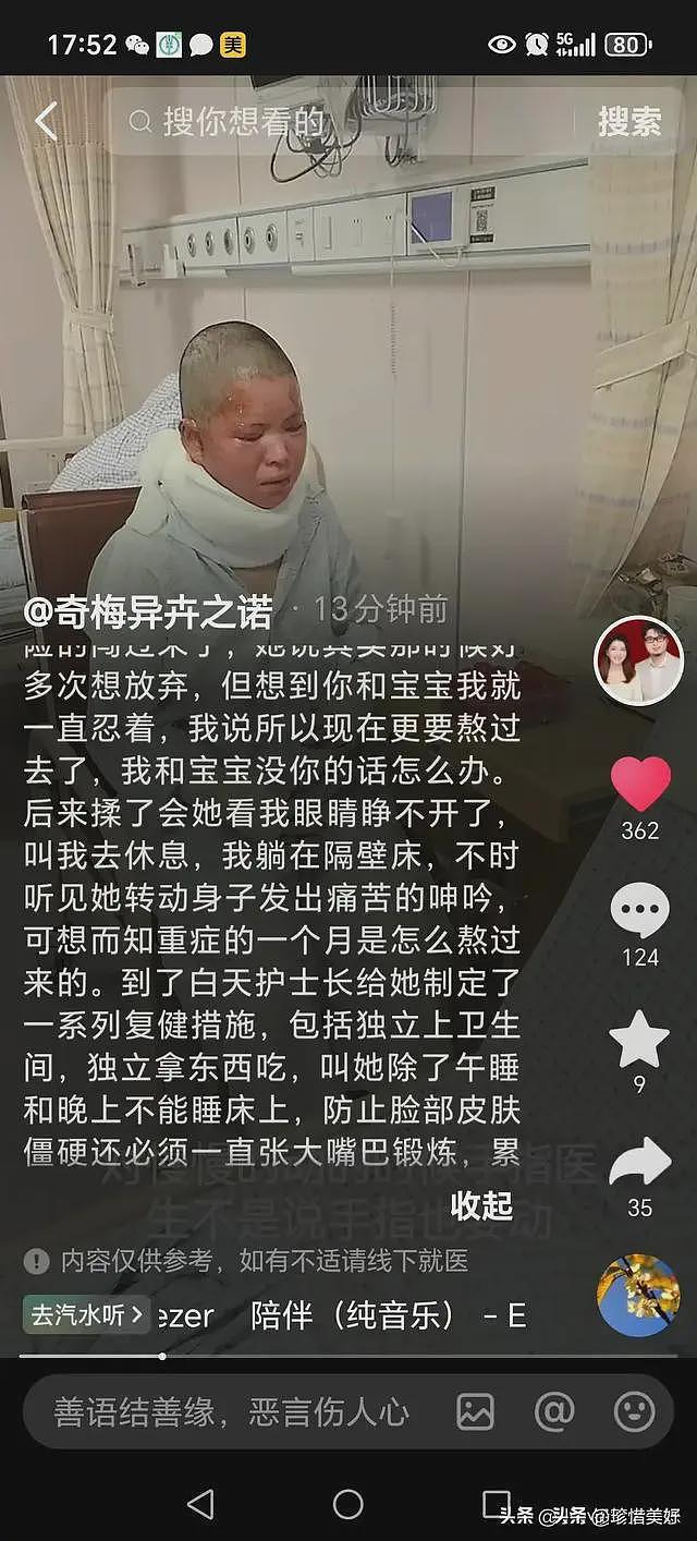 烧伤妈妈第一次露脸，没有毁容，咬牙锻炼坐马桶，需一直张大嘴巴（组图） - 7