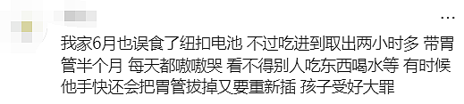 太危险！澳洲2岁孩子差点丢了命！这种玩具千万别让孩子们碰啦...（组图） - 17