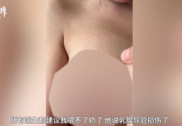 23岁女隆胸花18万变“石头奶”还失哺乳能力，揭发假医生非法行医（组图） - 6