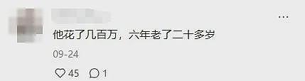 为变年轻，46岁富豪3年狂烧3000w，网友：成功变老15岁...（组图） - 36