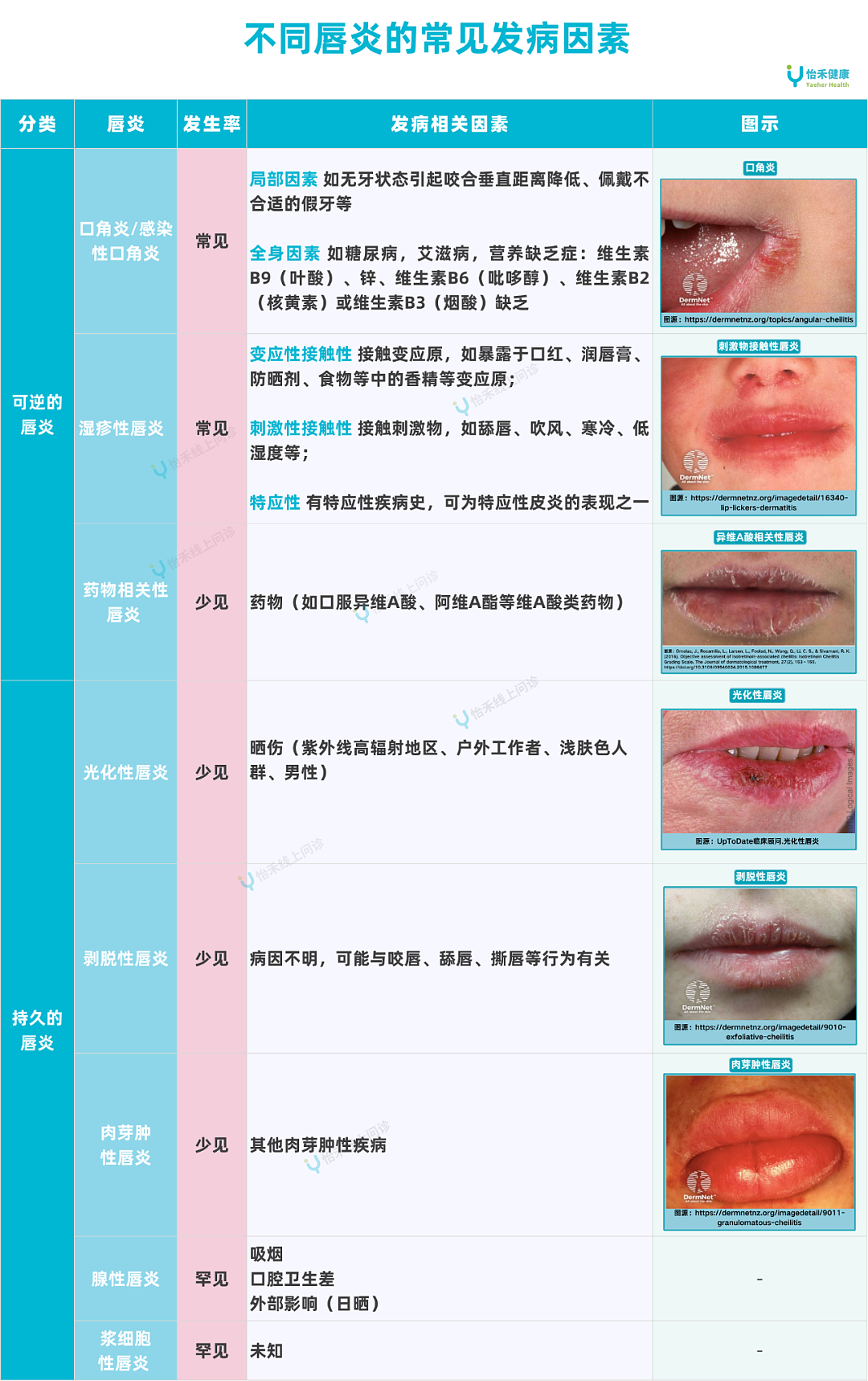 嘴巴老发干、起皮，别以为是缺水！可能是这种疾病的信号（组图） - 2