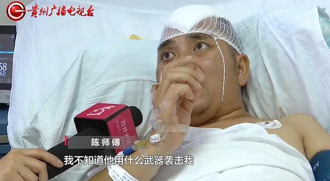 男子聚会上因不喝酒被朋友揍进ICU，头盖骨取出10多块（组图） - 2