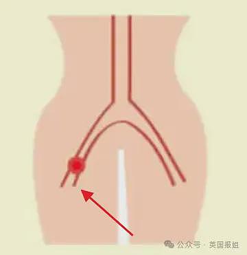 俄17岁少女喂猪时被围攻啃食身亡？尸检曝更惊悚真相：有人故意把她扔进了猪圈（组图） - 7