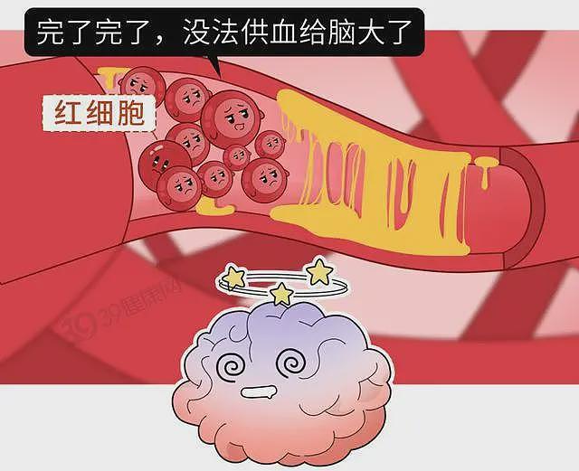 【健康】为什么中国脑梗越来越多？离不开这3个祸根，你可能也中招了（组图） - 3