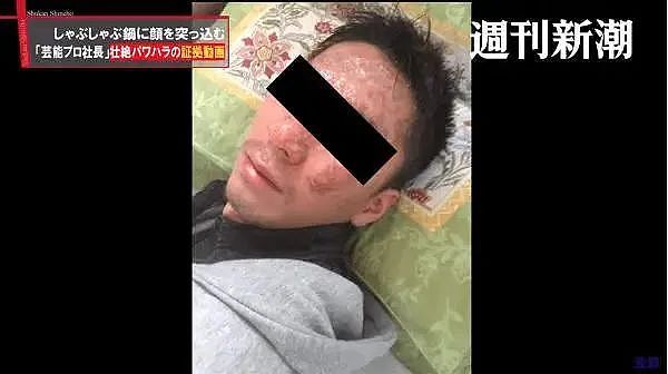 好变态！日式职场霸凌又火了：逼迫同事闯轨自杀、把头按进火锅、塞鞭炮进鼻腔引爆...（组图） - 26