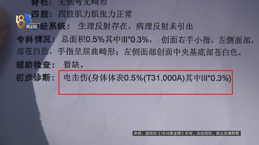 后怕！5岁男童瞬间晕厥，筋都断了……街上常见，看见立即远离（组图） - 5