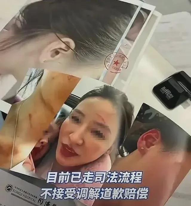 女老师自诉被前夫爸爸掐脖拖行扇巴掌，听完全程和原因我一点同情不起来（视频/组图） - 3