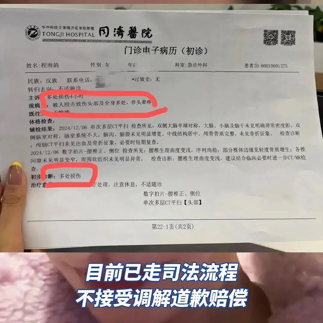 女老师自诉被前夫爸爸掐脖拖行扇巴掌，听完全程和原因我一点同情不起来（视频/组图） - 2