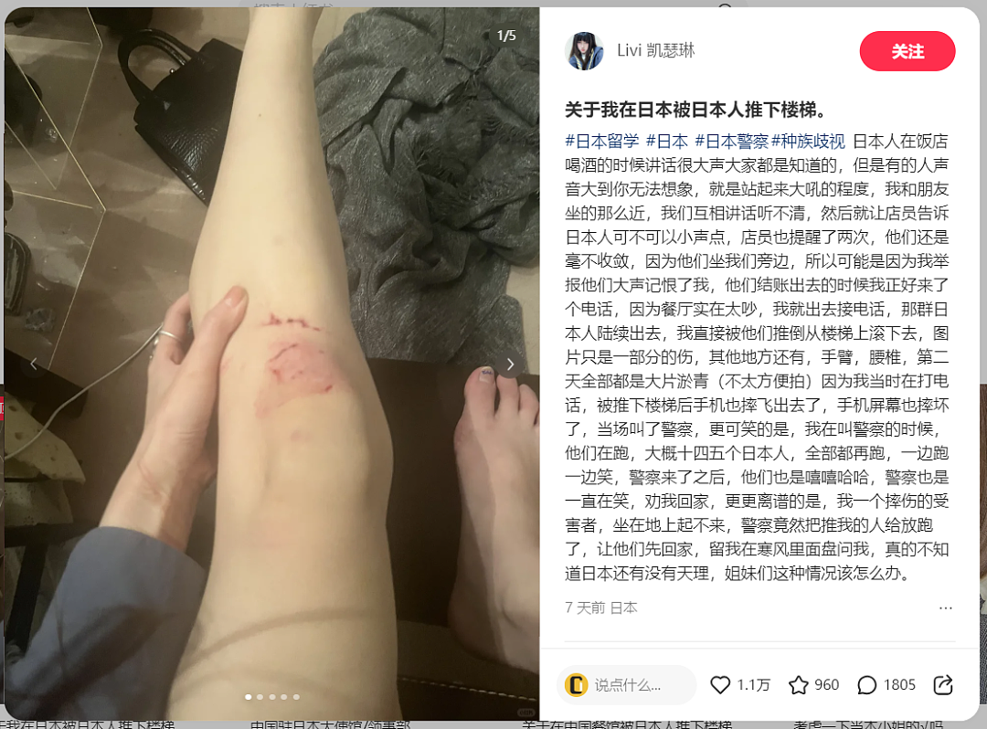 中国女留学生被日本人推下楼梯：施暴者嘲笑逃跑，警方冷漠处理，领事馆介入…（组图） - 3