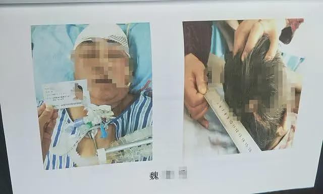 母亲过马路被撞重伤，女儿目睹惨祸应激病倒身亡（组图） - 1