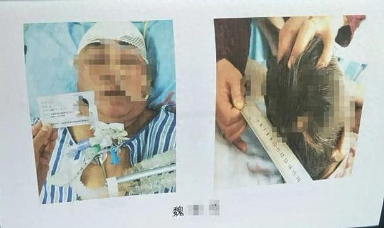 被吓死了？甘肃女目睹母车祸后5天猝死，医生揭死因（组图） - 1