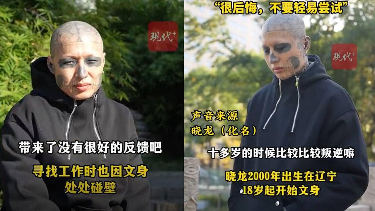 内地男把脸纹成“猫熊眼”，求职处处碰壁！大感后悔终痛下决心洗光（组图） - 1