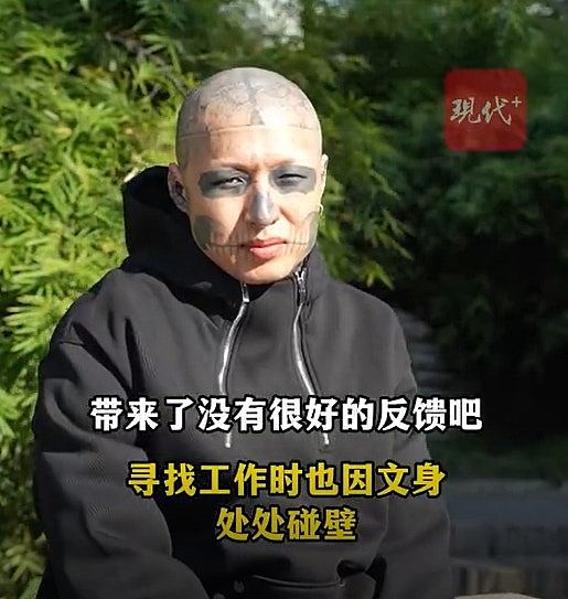 内地男把脸纹成“猫熊眼”，求职处处碰壁！大感后悔终痛下决心洗光（组图） - 2