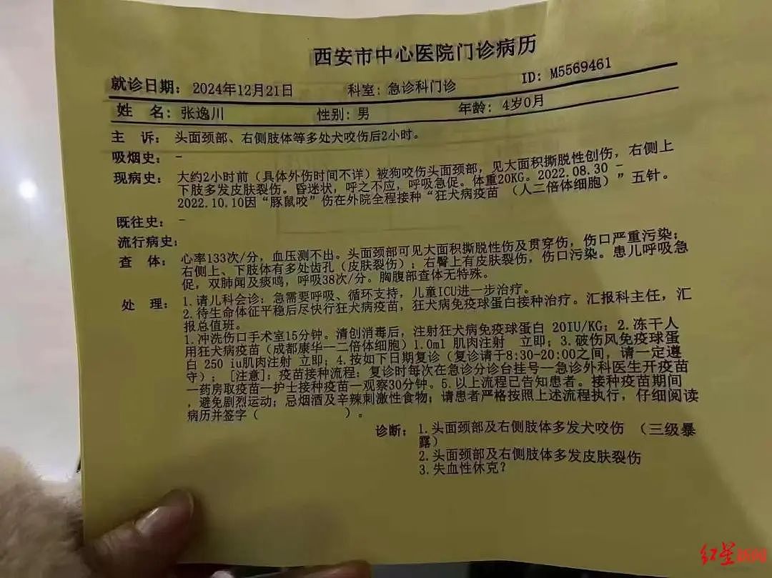 西安4岁男童遭恶犬袭击，致脸部大面积创伤，目前仍在ICU昏迷！警方调查犬只来源，父亲发声（组图） - 1