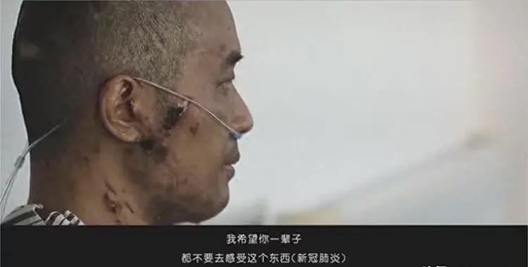 全身溃烂生不如死，丧失生育功能，武汉首批新冠患者如今结局如何（组图） - 1