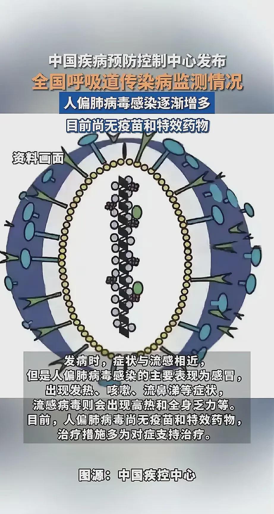 【健康】“人偏肺病毒”感染侵袭，无疫苗无特效药，这...（组图） - 3