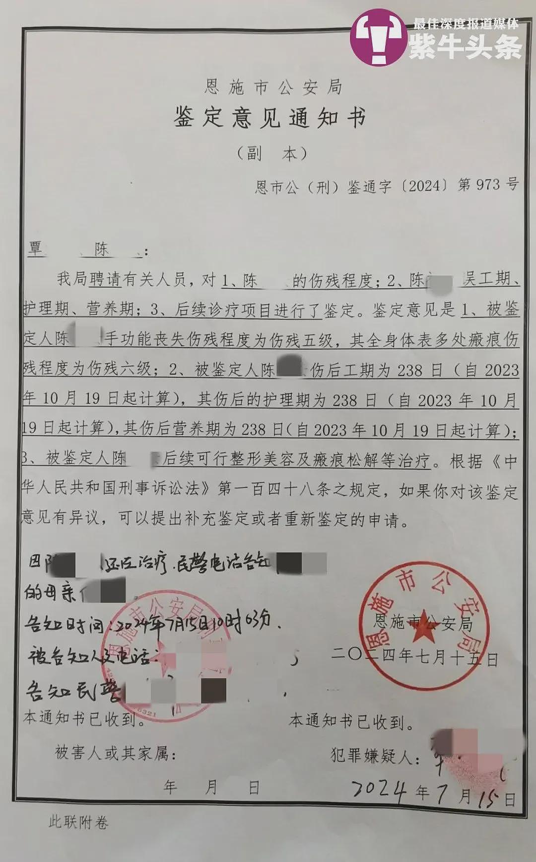 女孩被前男友泼汽油烧伤致残毁容，凶手获刑12年（组图） - 3