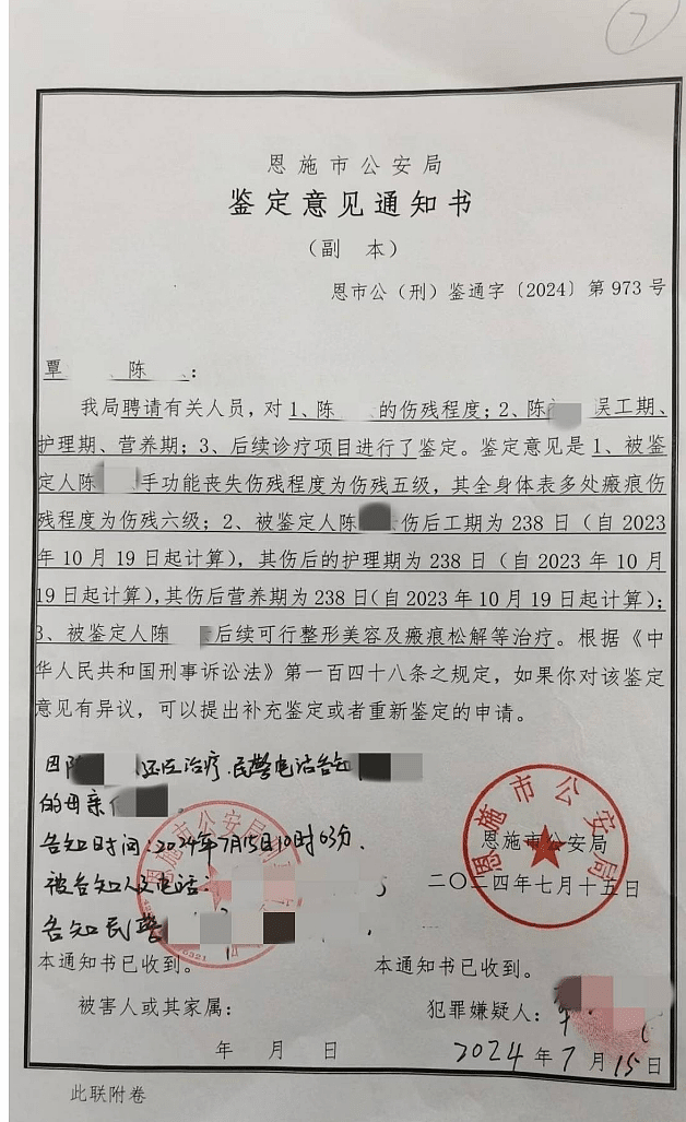 湖北男子不满分手泼汽油！致女友全身7成烧伤毁容截肢恐怖画面曝（视频/组图） - 4