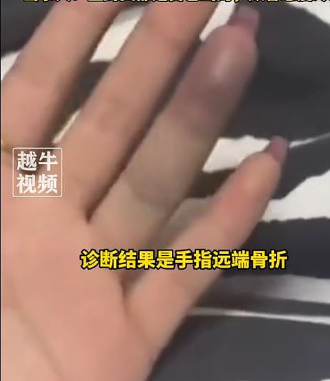 撞断指骨！桌球中心黑丝女助理摆球遭客人开球击打致骨折引发热议（视频/组图） - 3