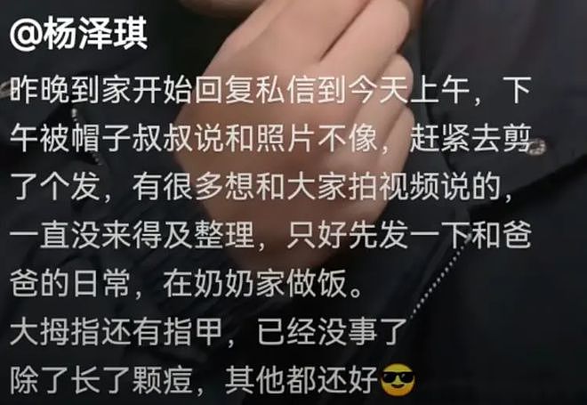 杨泽琪更新视频，全程微笑不语，指甲变黑脱落，疑似不会说话了？（组图） - 4