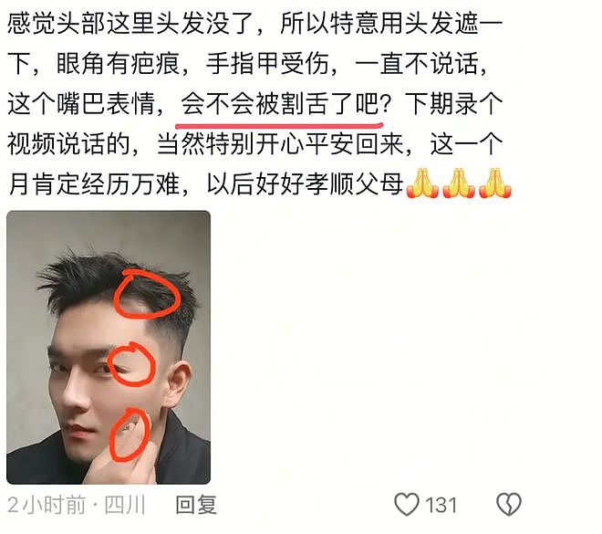 杨泽琪更新视频，全程微笑不语，指甲变黑脱落，疑似不会说话了？（组图） - 6