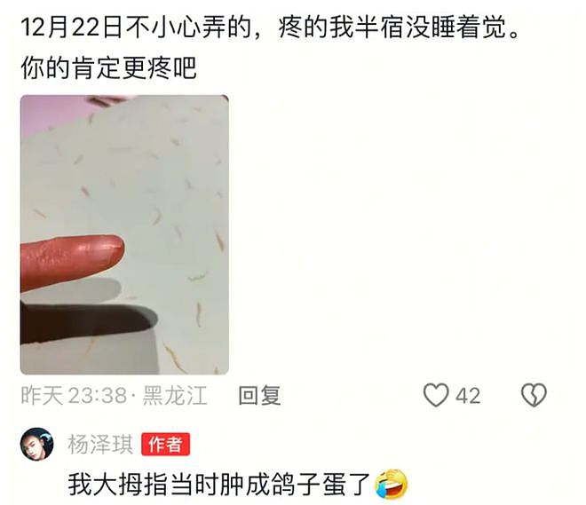 杨泽琪更新视频，全程微笑不语，指甲变黑脱落，疑似不会说话了？（组图） - 5