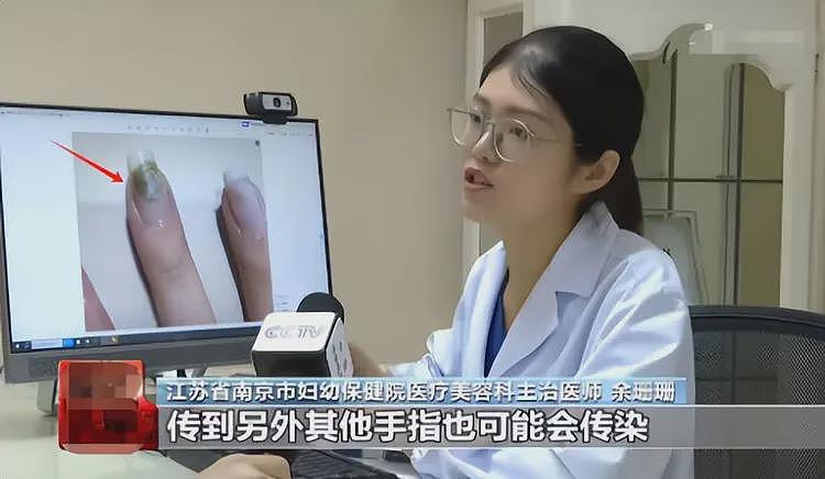 央视痛批美甲乱象！指甲断层、感染HPV，网友：过年致死三件套（组图） - 14