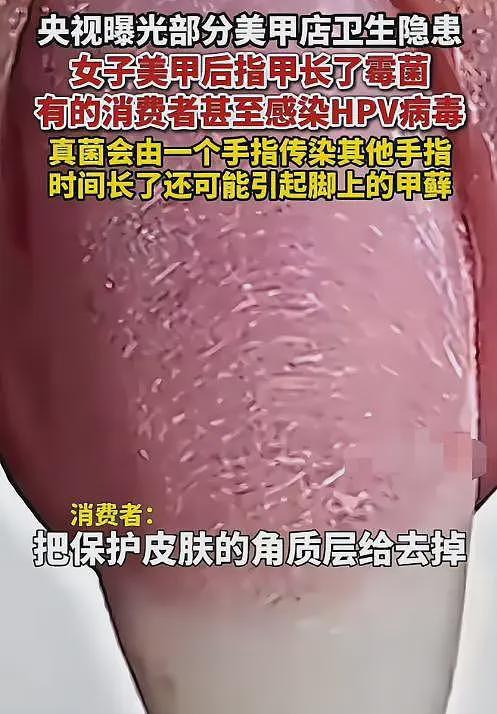 央视痛批美甲乱象！指甲断层、感染HPV，网友：过年致死三件套（组图） - 5