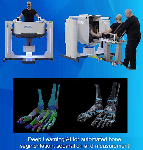 【异动股】医学成像智能扫描公司Curvebeam AI(ASX：CVB)销售势头强劲 美国订单增长迅猛飙升 - 4