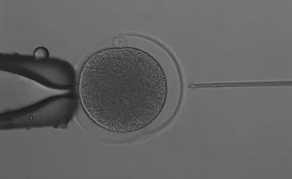 昆士兰大学透过体外受精（IVF）技术，培育出全球首个袋鼠胚胎。取自昆士兰大学网站
