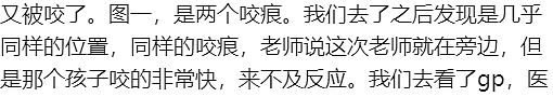 墨尔本东南区幼儿园离大谱，孩子反复被咬伤！华人宝妈紧急求助（组图） - 5