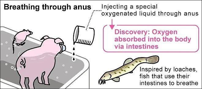 到底有多少人学会了用肛门呼吸？（组图） - 6
