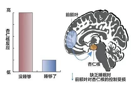 你以为正常，实则可能是严重缺觉的4种表现（组图） - 4